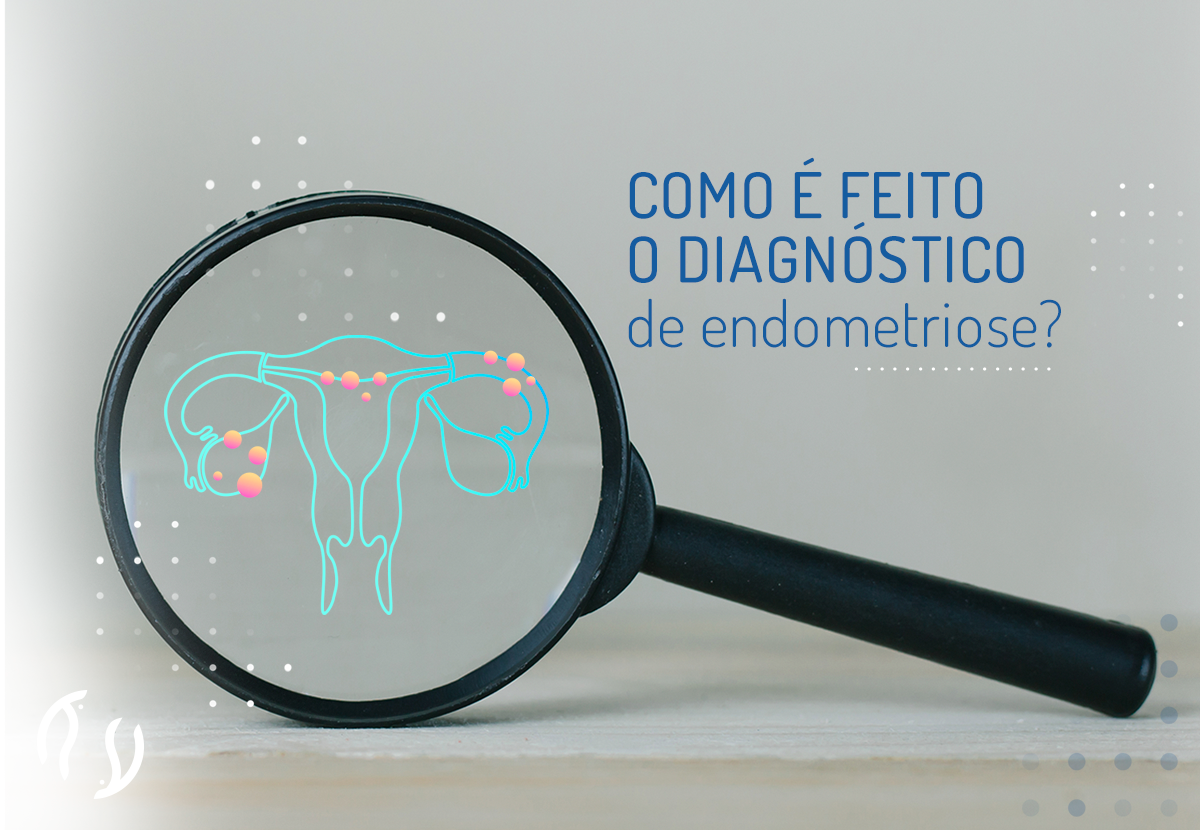 Como é feito o diagnóstico de endometriose?