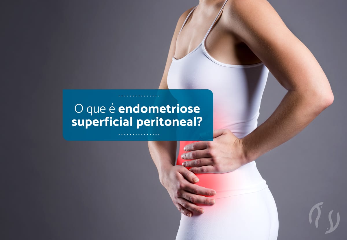 O que é endometriose superficial peritoneal?