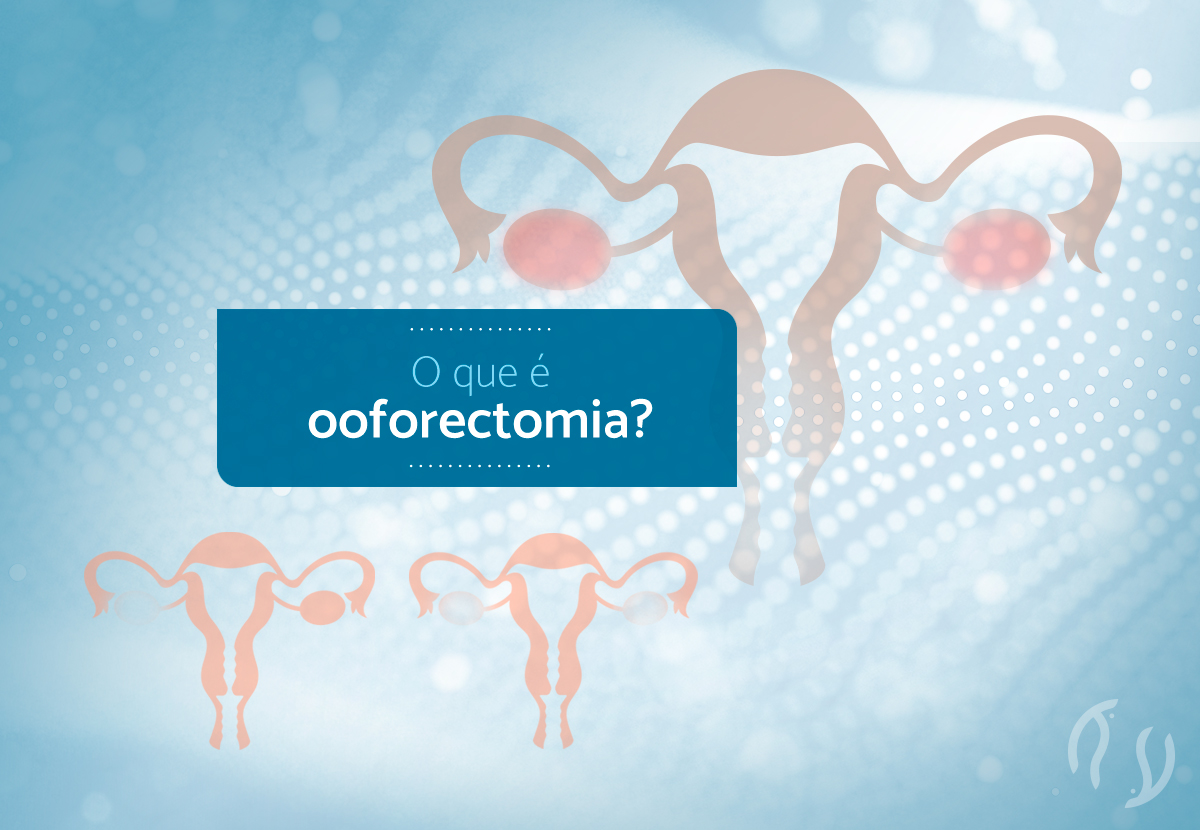 Ooforectomia bilateral na pré-menopausa foi mais fortemente