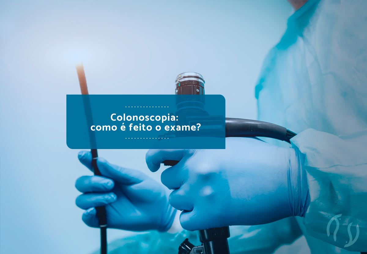 Colonoscopia: como é feito o exame?