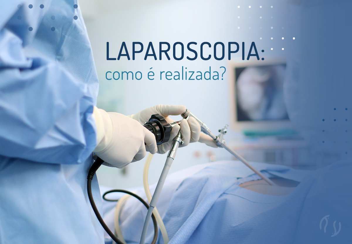 O uso da laparoscopia para a realização das cirurgias de retirada dos focos  visíveis da endometriose tem se mostrado superior à técnica abdominal, By Dr. Yulo Césare