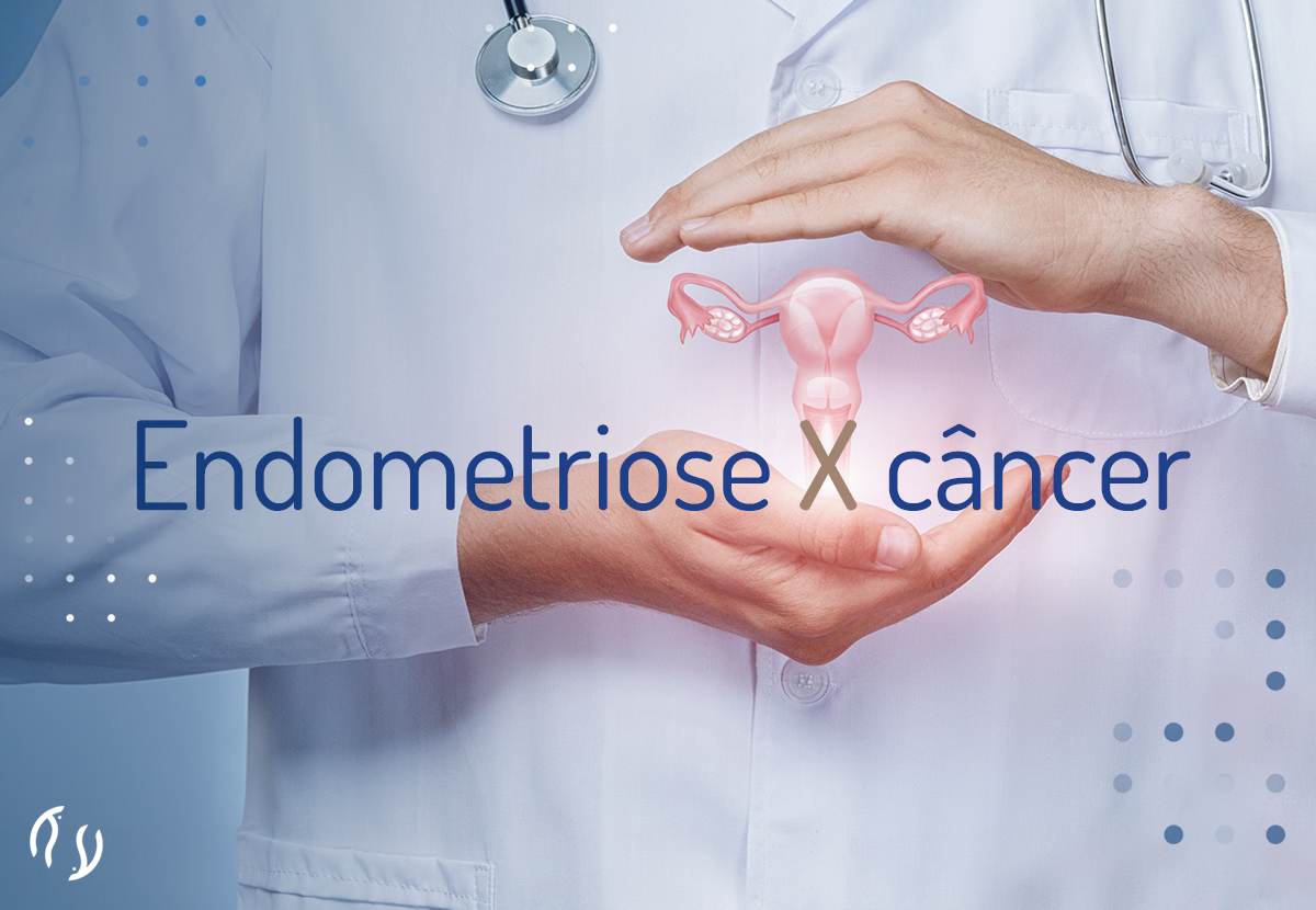 Endometriose x câncer