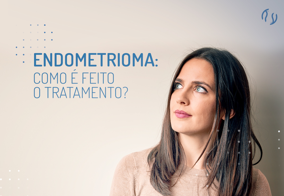 Endometrioma Como é Feito O Tratamento Dr Luiz Flávio 2004