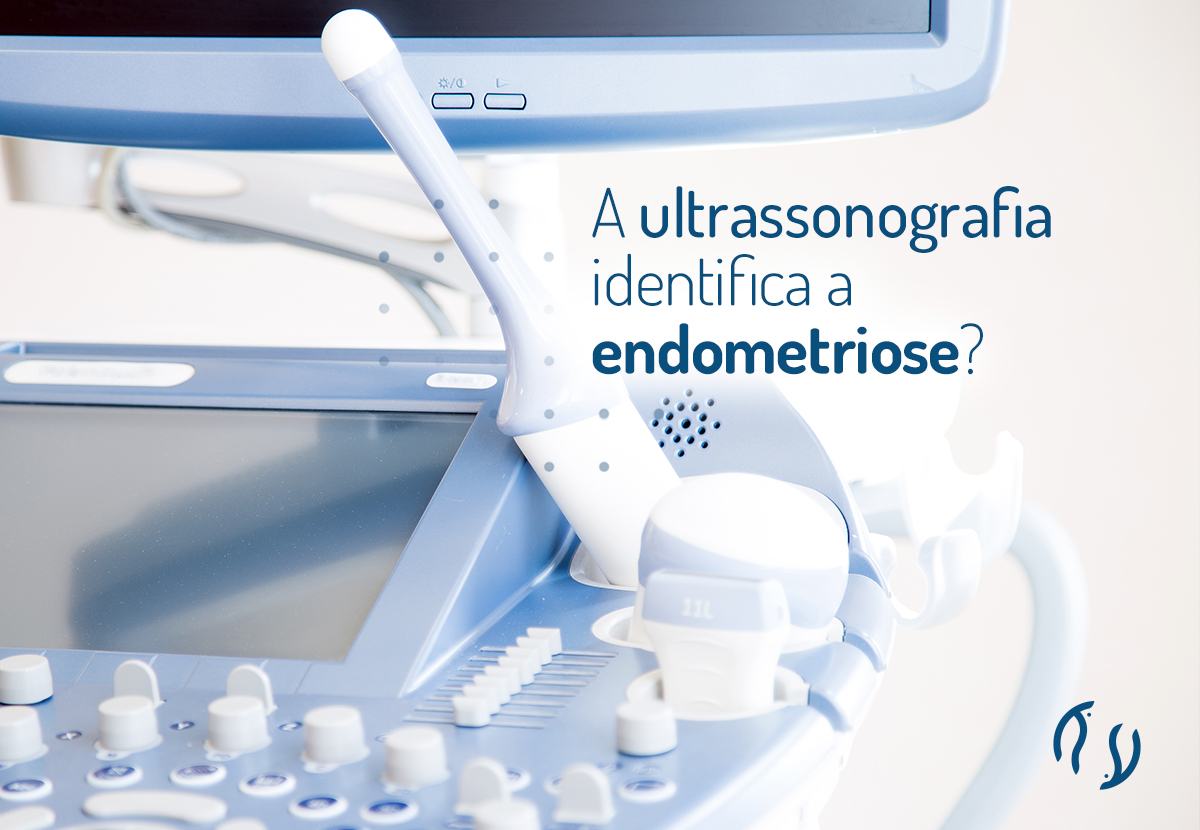 A ultrassonografia identifica a endometriose?
